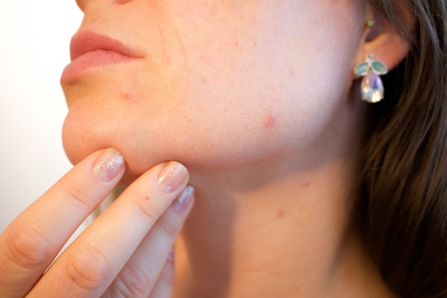 What Causes Those White Bumps On Your Face? Here’s Everything You Need To Know.